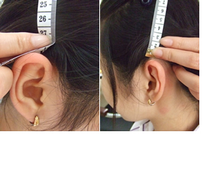 耳から頭頂部を経由して反対側の耳まで計測するイメージ